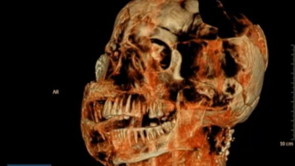 Novos exames de tomografia computadorizada revelam que as vítimas de Pompeia tinham dentes excelentes