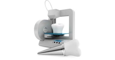 L'impression 3D en dentisterie : une révolution en marche