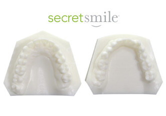 Wired Orthodontics Secret Smile