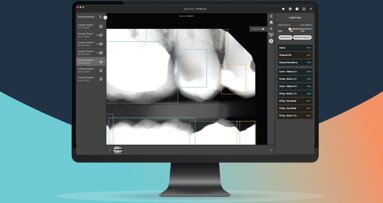 Pearl introduces AI solution for dental pathology detection