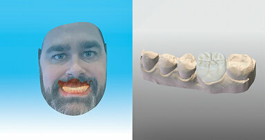 Dental Wings announces release of major software updates