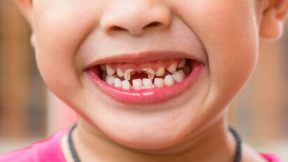 New study may help in better prevention of early childhood caries