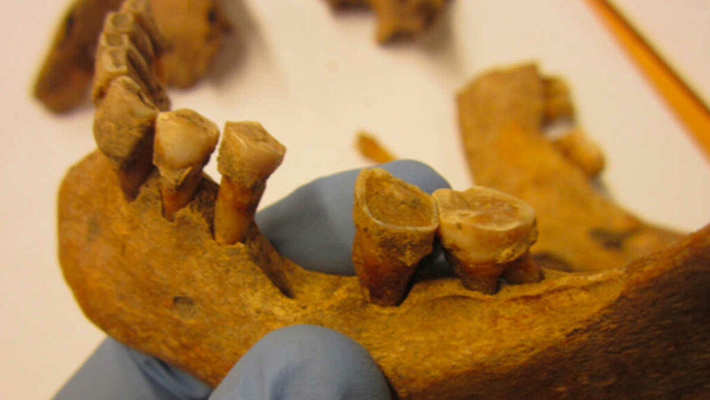 Studium středověkého plaku ukazuje, jak se změnily orální mikrobiomy
