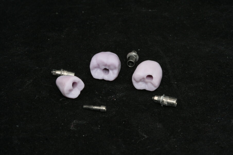 Fig. 19: Milled IPS e.max CAD abutment crown before bonding