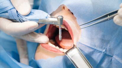 Henry Schein entra no mercado brasileiro de implantes dentários com a aquisição da SIN
