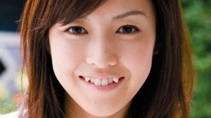 Trend nepravilnih zuba popularan među mladim Japankama podigao tražnju za estetskim intervencijama