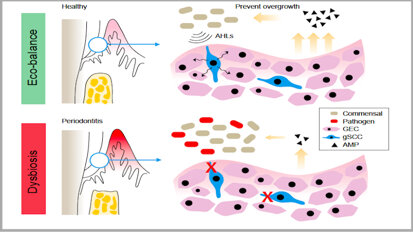 Study identifies gingival cells that can protect against periodontitis.