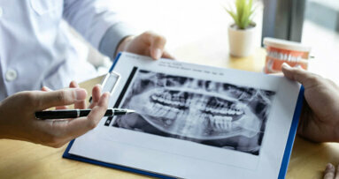 Nova pesquisa pode prevenir danos no maxilar de pacientes com câncer que precisam de cirurgia oral