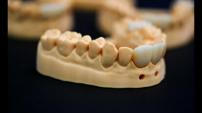 UnionTech EvoDent Series  3D Printing Process for Dental Models
