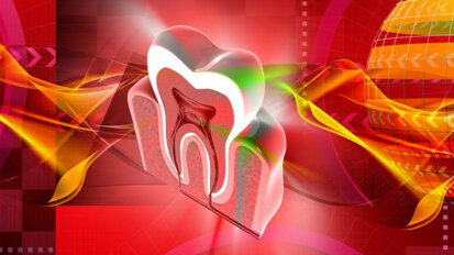 Zubi otporni na kvarenje: molekul nazvan „Keep 32“ uništava bakterije koje mogu uzrokovati karijes
