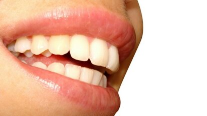 Movimento dentale: scienza della salute o eccessiva cosmetica?