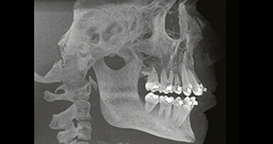 Použití technologie Cone Beam v ortodoncii