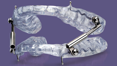 Glidewell Dental introduces a new oral sleep appliance