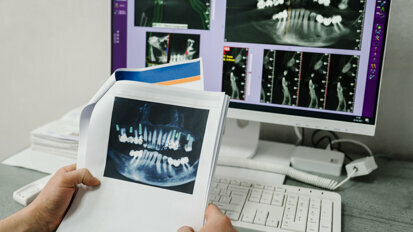 Big data could mean better outcomes for implantology