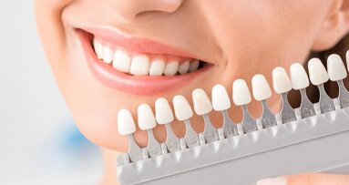 Researchers develop less destructive method to whiten teeth