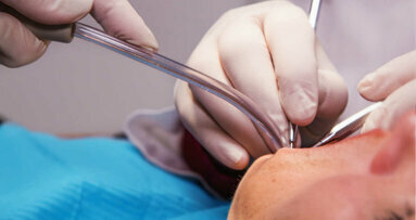 La periodontitis podría aumentar el riesgo de accidente cerebrovascular