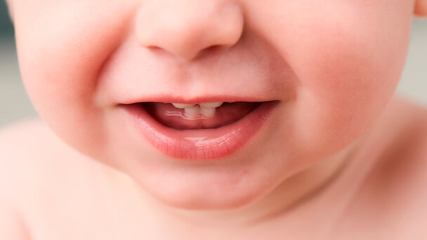 Uno studio sulla dentizione primaria collega l’esposizione alle tossine nei primi anni di vita all’autismo