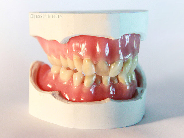 Hand-sculpted recreation of David Bowie's natural teeth.