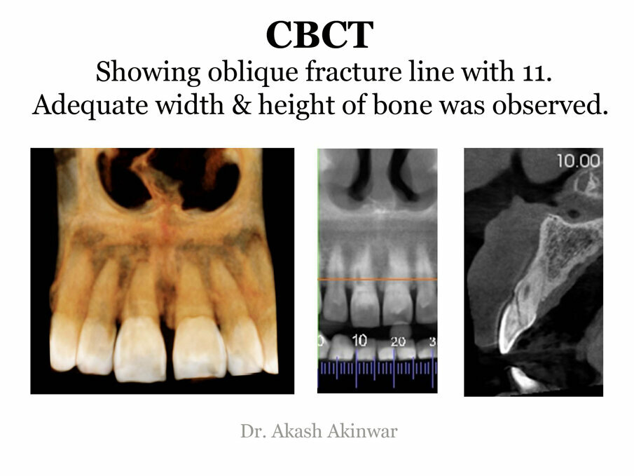 Fig 5: CBCT investigations
