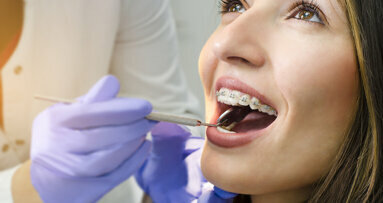 Survey shows number of UK adults seeking orthodontic treatment remains high