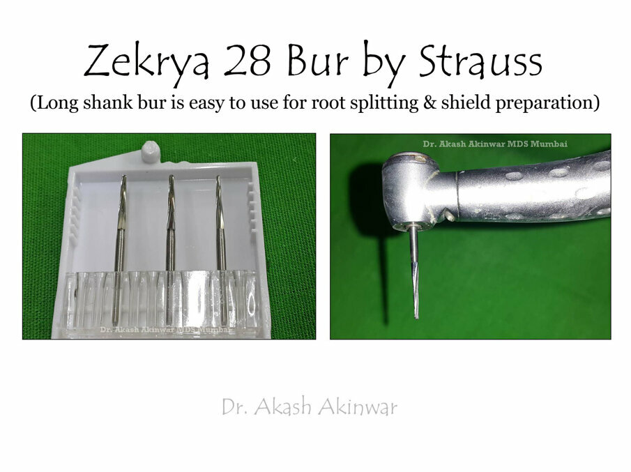 Fig 9: Zekrya 28 bur used for the shield preparation