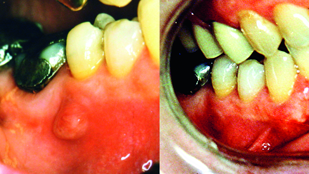 Long-term analysis of primary, non-surgical root canal treatments – A retrospective study