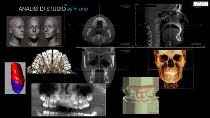 L’ortodonzia oggi tra 2D e 3D vive il presente e guarda al futuro