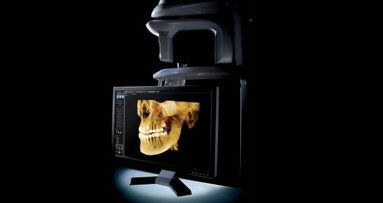 Tomograf CS 9300 –  nowa jako obrazowania   stomatologiczno-laryngologicznego