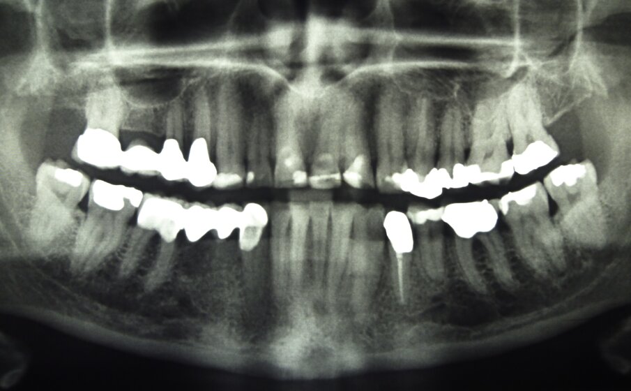 Fig. 2: Radiograph of initial situation