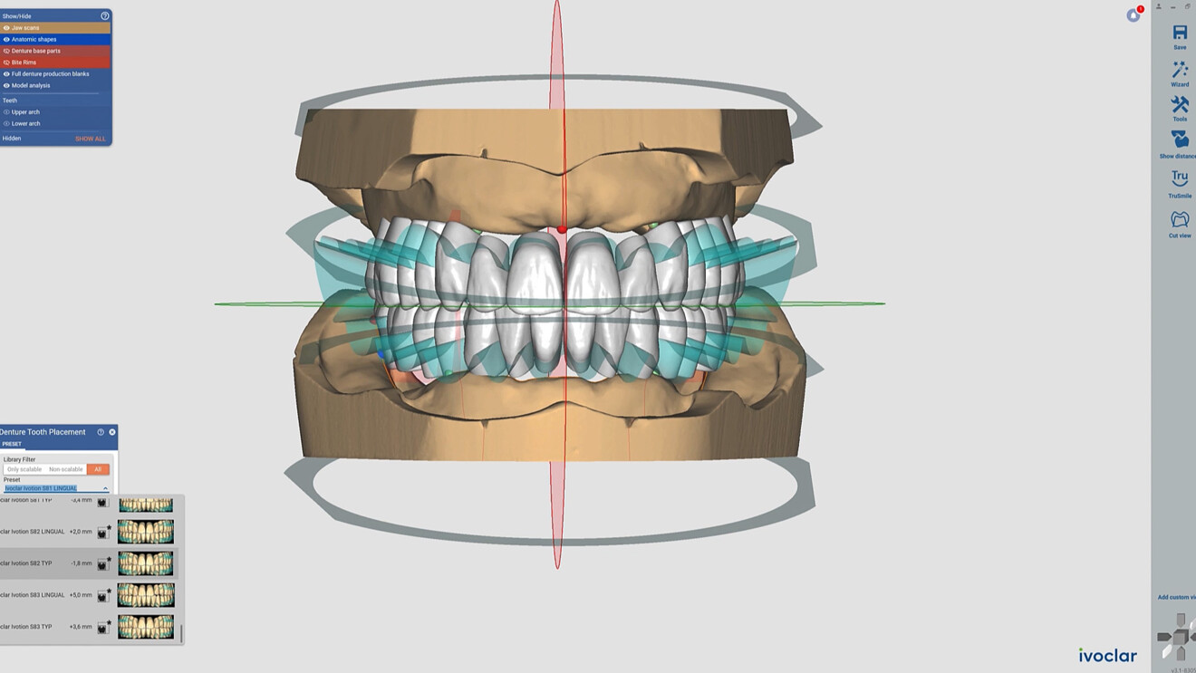 Ivoclar’s Ivotion denture system.