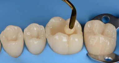 Free webinar highlights advantages of biomimetic approach to dentistry