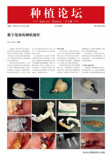 Implant Tribune China No. 2, 2018