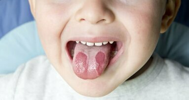 רופאים מספקים הצצה על מצב לשון בלתי מוסבר