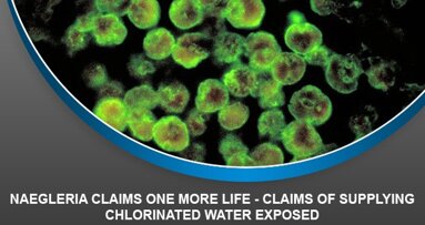 Naegleria Claims One More Life – Claims of supplying chlorinated water exposed