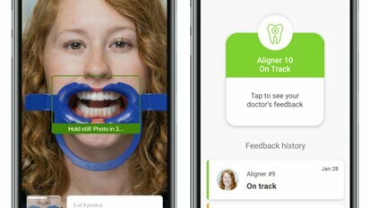 How Invisalign Virtual Care AI 3.0 benefits both practice and patients
