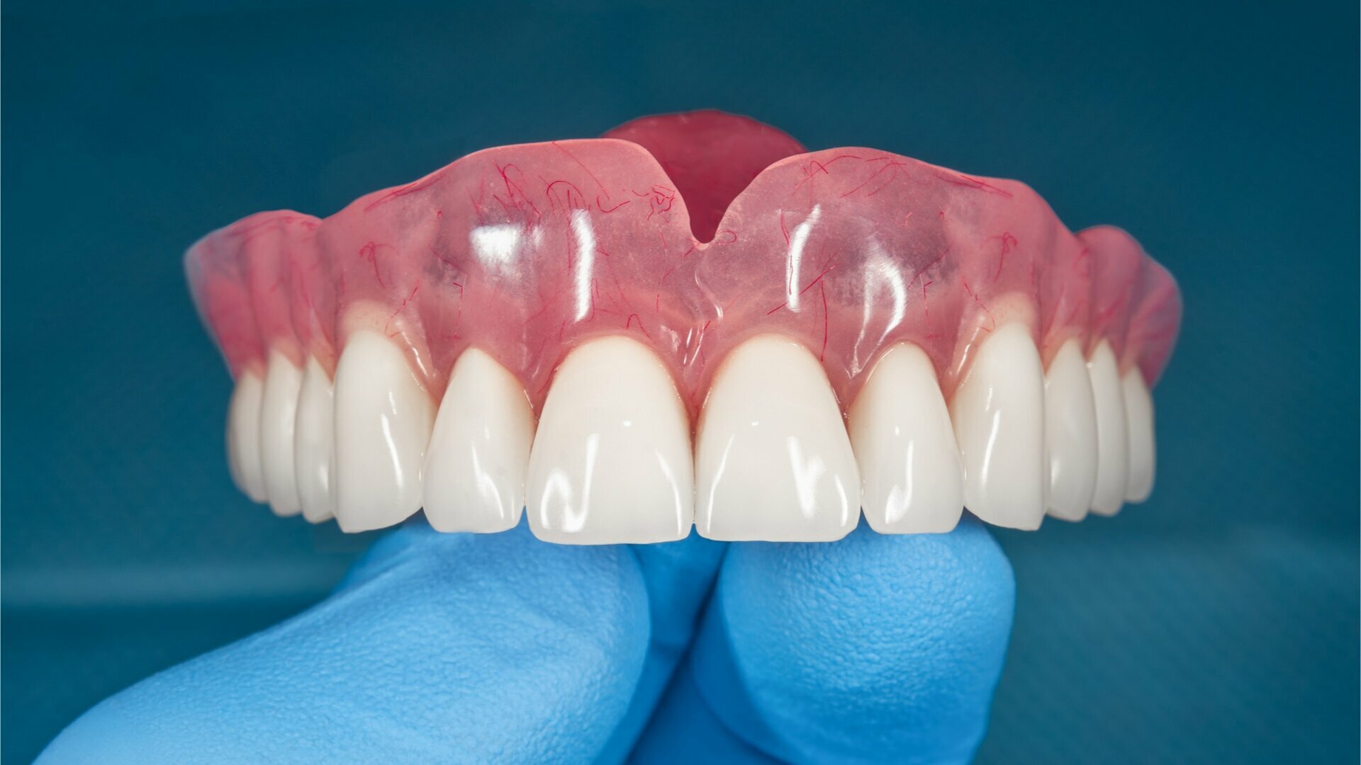 The future is now: Revolutionising dentistry with digital dentures