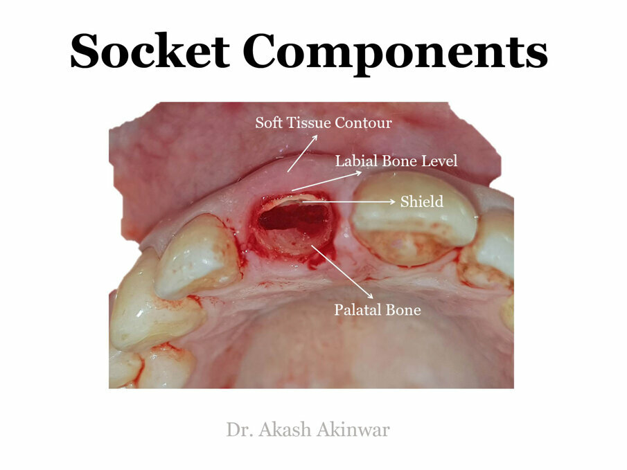 Fig 14: Socket components