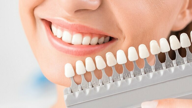 Учени разработват по-нежен метод за избелване на зъбите