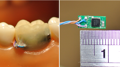 Китайски зъбен сензор може да улесни наблюдаването на пациентите