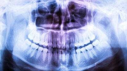 Aumentano le radiografie se i dentisti son pagati a incentivo