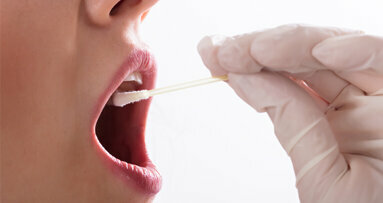 Früherkennung von Mundkrebs: Biomarker im Speichel