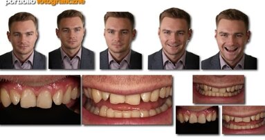 Praktyczne sposoby zastosowania Digital Smile Design w codziennej pracy lekarza dentysty