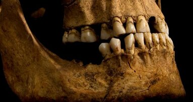 Dentes revelam detalhes do estilo de vida de Ricardo III