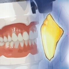 Acrylic Materials & Artificial Teeth