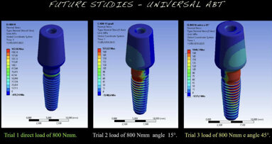 Analisi meccanica delle specifiche di tre diversi dispositivi di ritenzione protesica su impianti