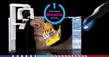 A winning combination: CAD/CAM and CBCT data in one