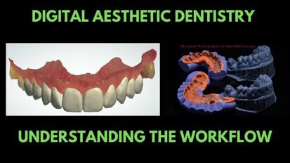 Digital Aesthetic Dentistry: 6-Step Workflow Integrates Multiple Systems, Gadgets, and Tools