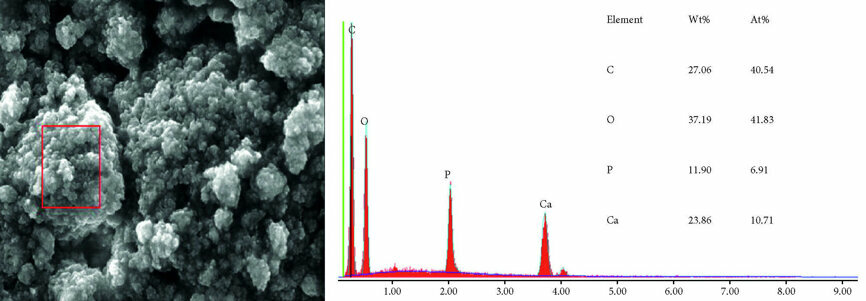 Fig 2c : Analyse EDS sous un grossissement de5 000 fois de la poudre de HAP I au contact d’une solution aqueuse. Les images montrent la forme cristallite et la tendance a la formation d’agrégats.