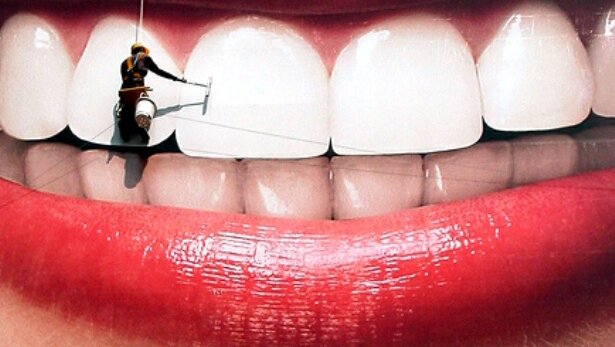 Zubna gleđ oslabljena beljenjem