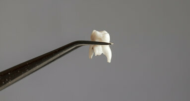 Machine-learning algorithms may help in predicting tooth loss